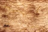 5 – Cellule corticali in visione superficiale